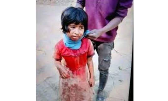 গলাকাটা অবস্থায় জঙ্গলে হাঁটছিল শিশু, কথা বলার শক্তিও নেই